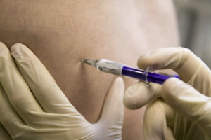 Injection Technique, Clinical Skills