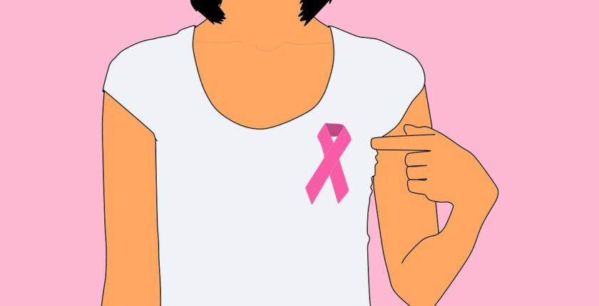 Ovarian Cancer